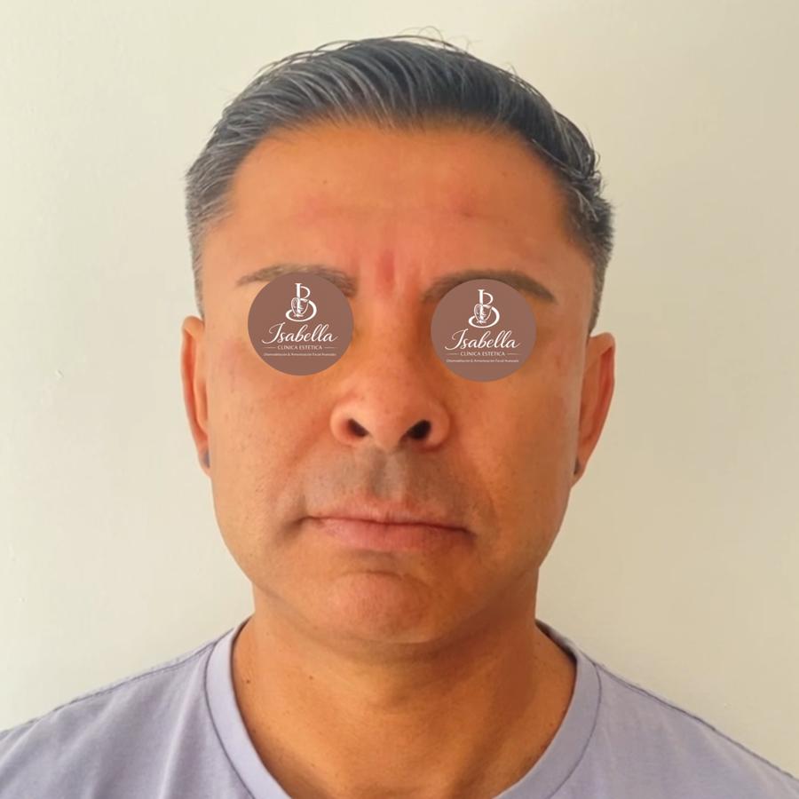 Después