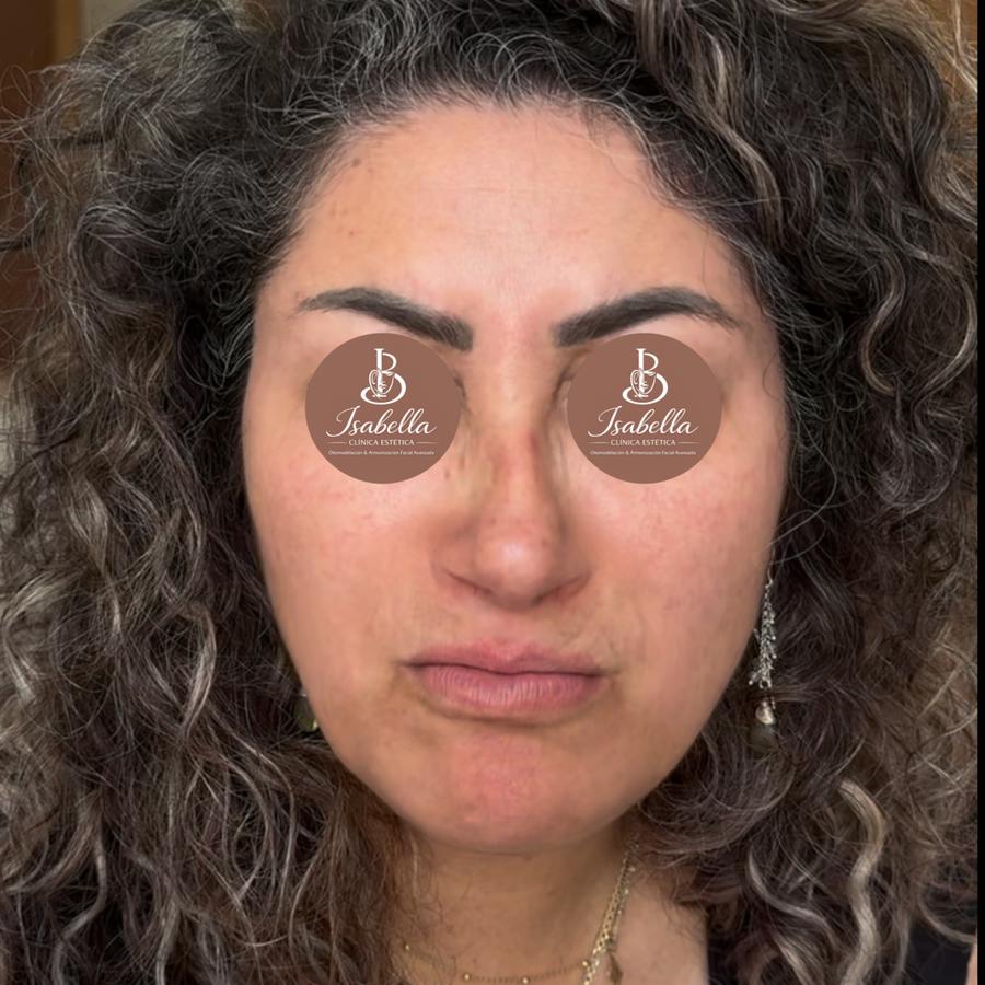 Después