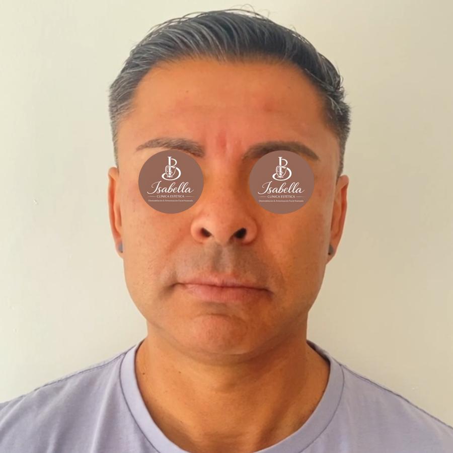 Después