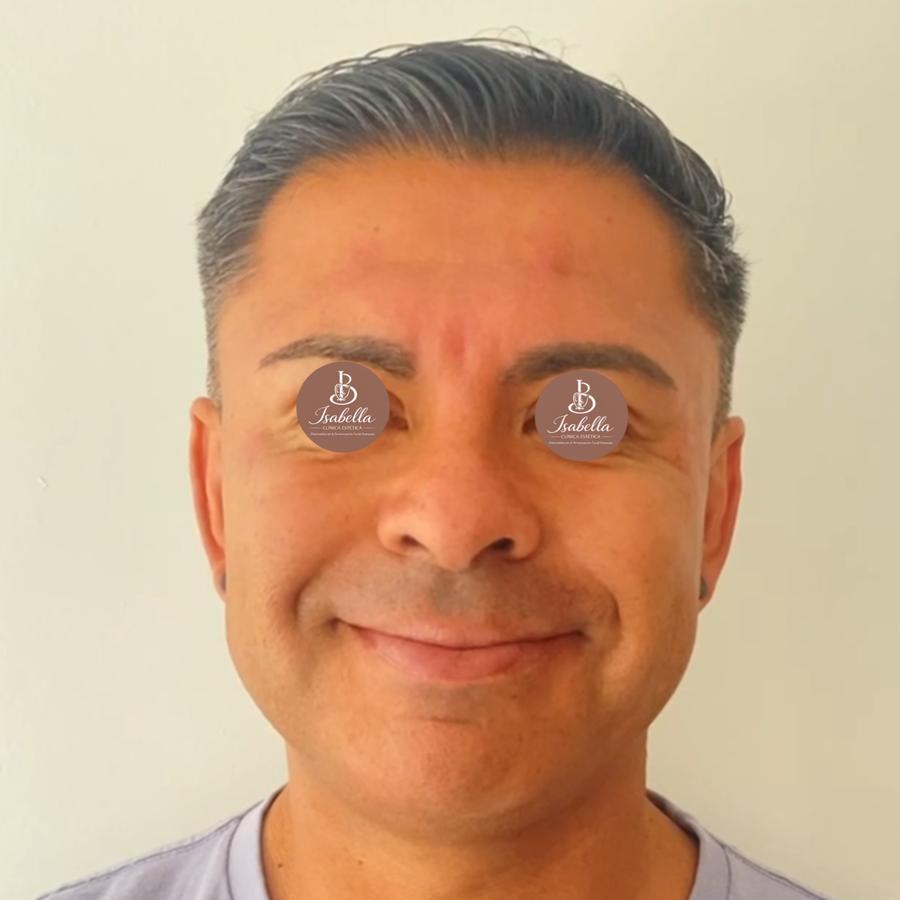Después