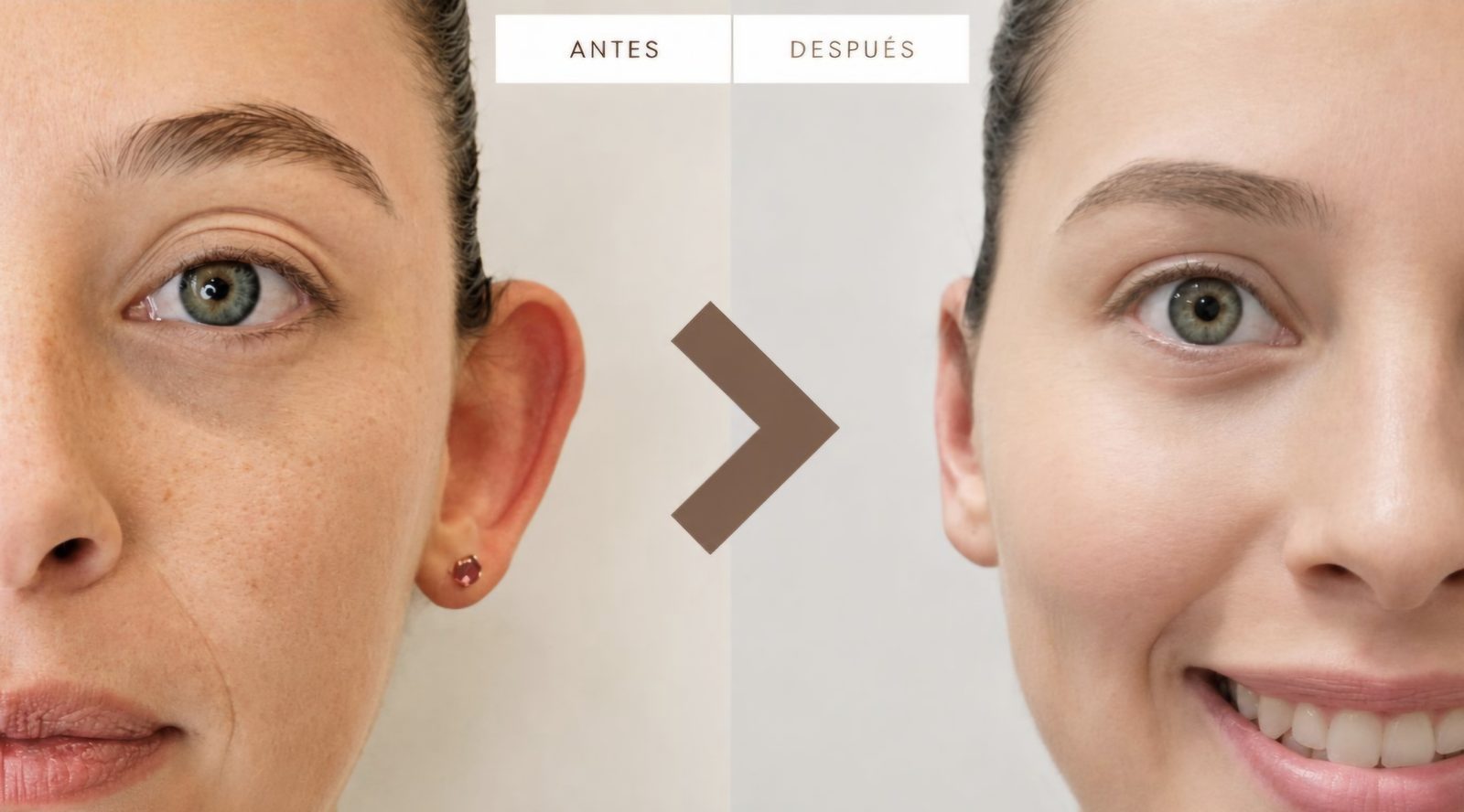 Otomodelación Definitiva - antes y después